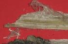 What is asbestos